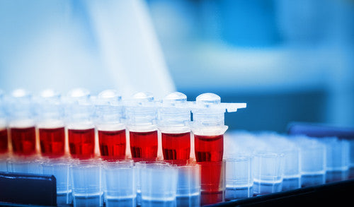 Should you have a PSA test for prostate cancer if you are over 75?