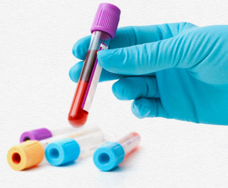 Hormone testing